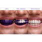 Purple Strips